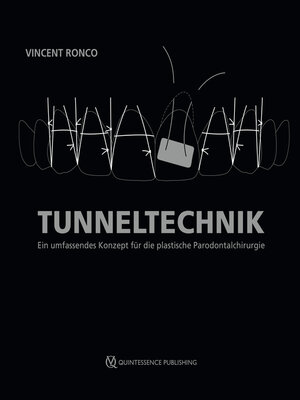 cover image of Tunneltechnik